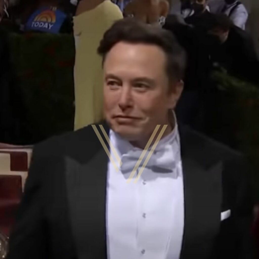 Elon Musk S Hair Transplant Before And After Transformation