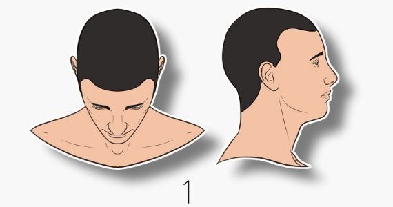 type 1 norwood hair loss scale