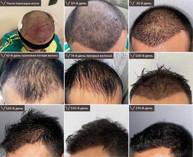 Как ускорить рост волос: рекомендации экспертов