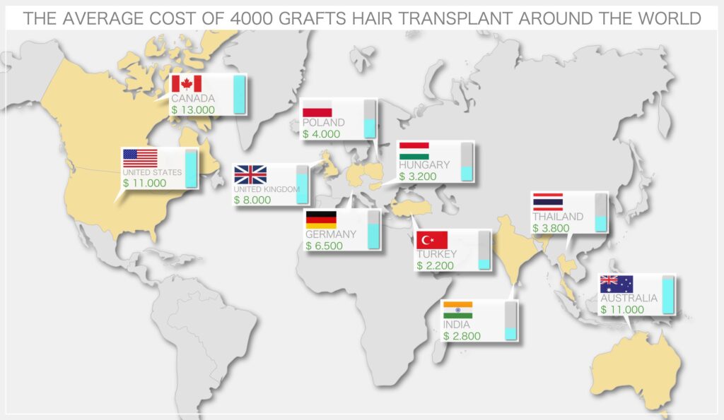 average cost of hair transplant operation around the world
