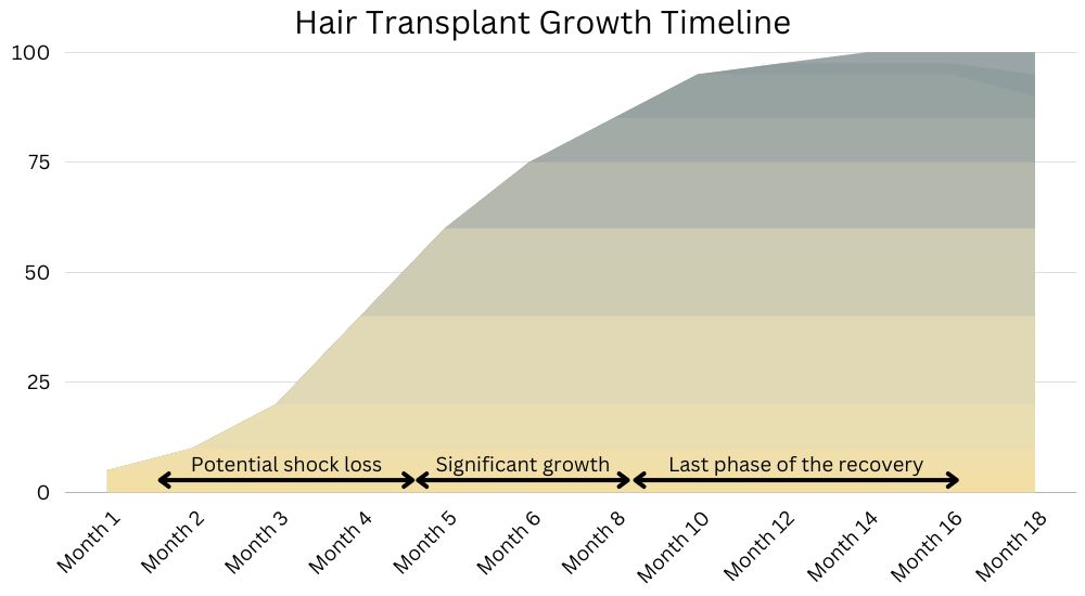 Hair Transplant Growth Timeline Chart