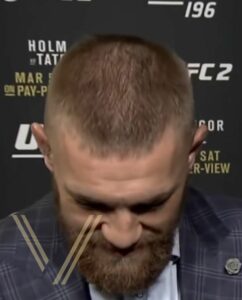 conor mcgregor hair loss front