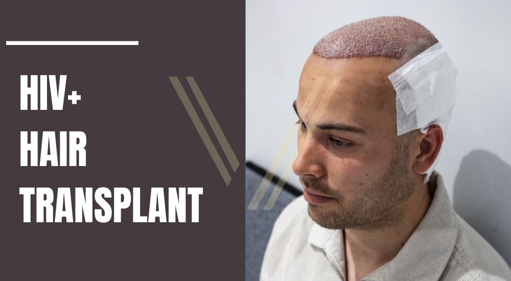 hiv+ hair transplant in turkey banner