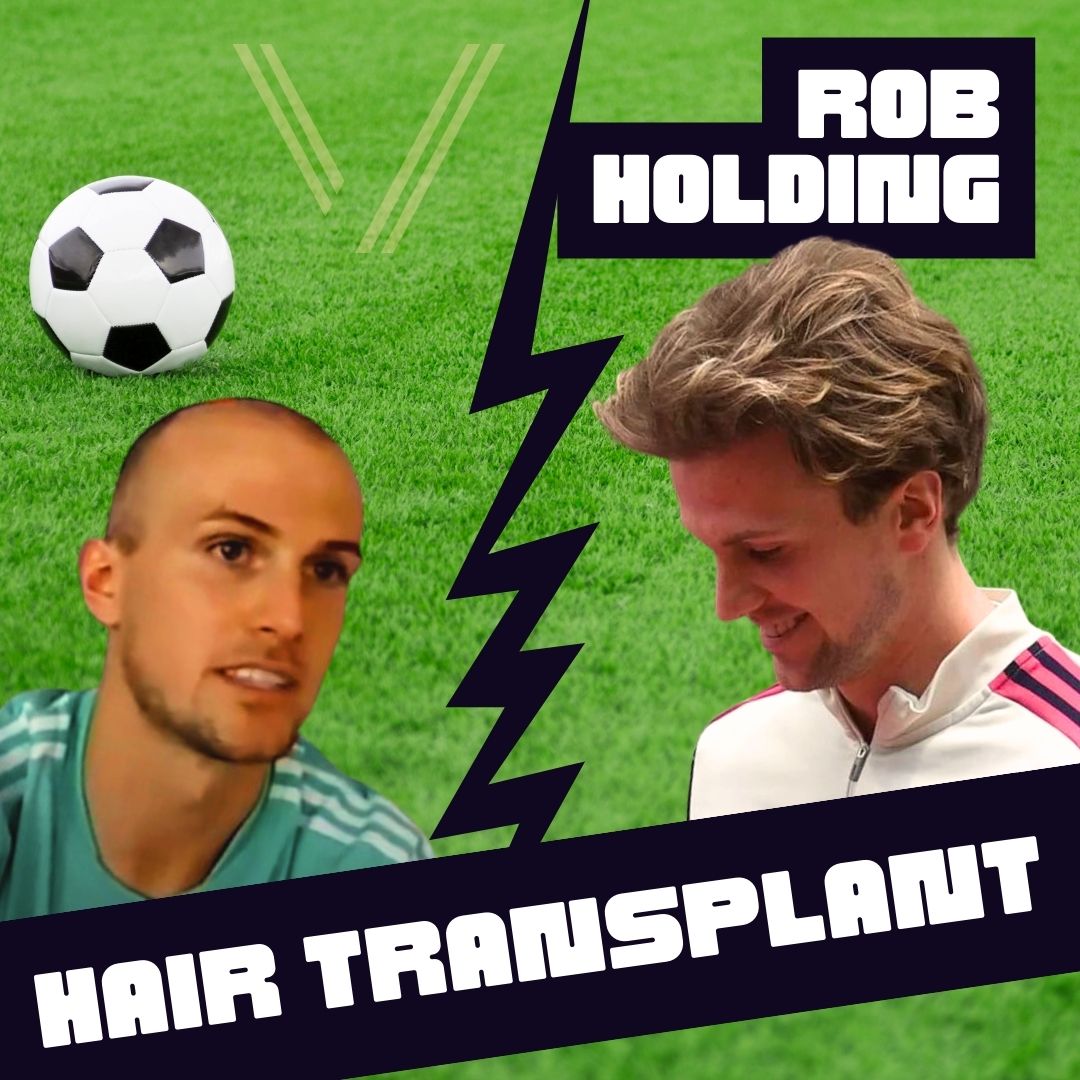 rob holding hair transplant before and after