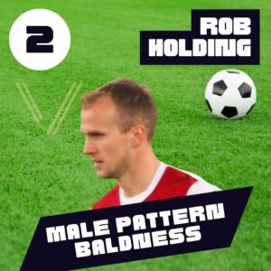 rob holding male pattern baldness 