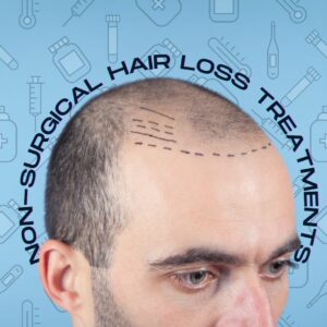Non-Surgical Hair Loss Treatments