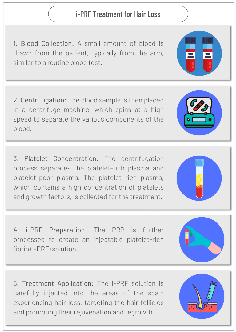 Steps of i-PRF Treatment for hair loss