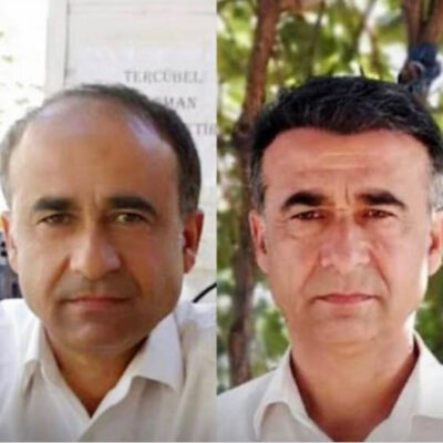 hair transplant 6000 grafts before and after man