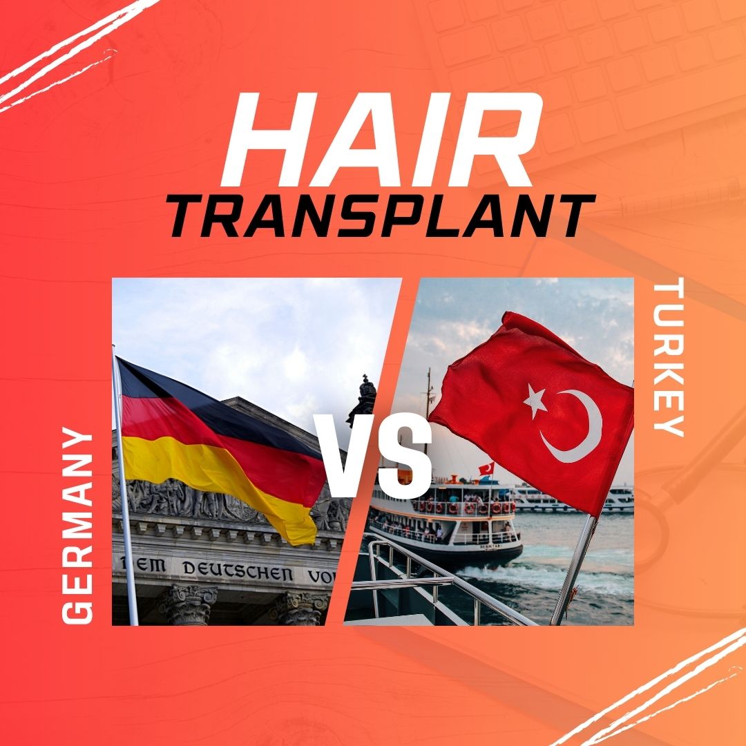 hair transplant germany vs turkey