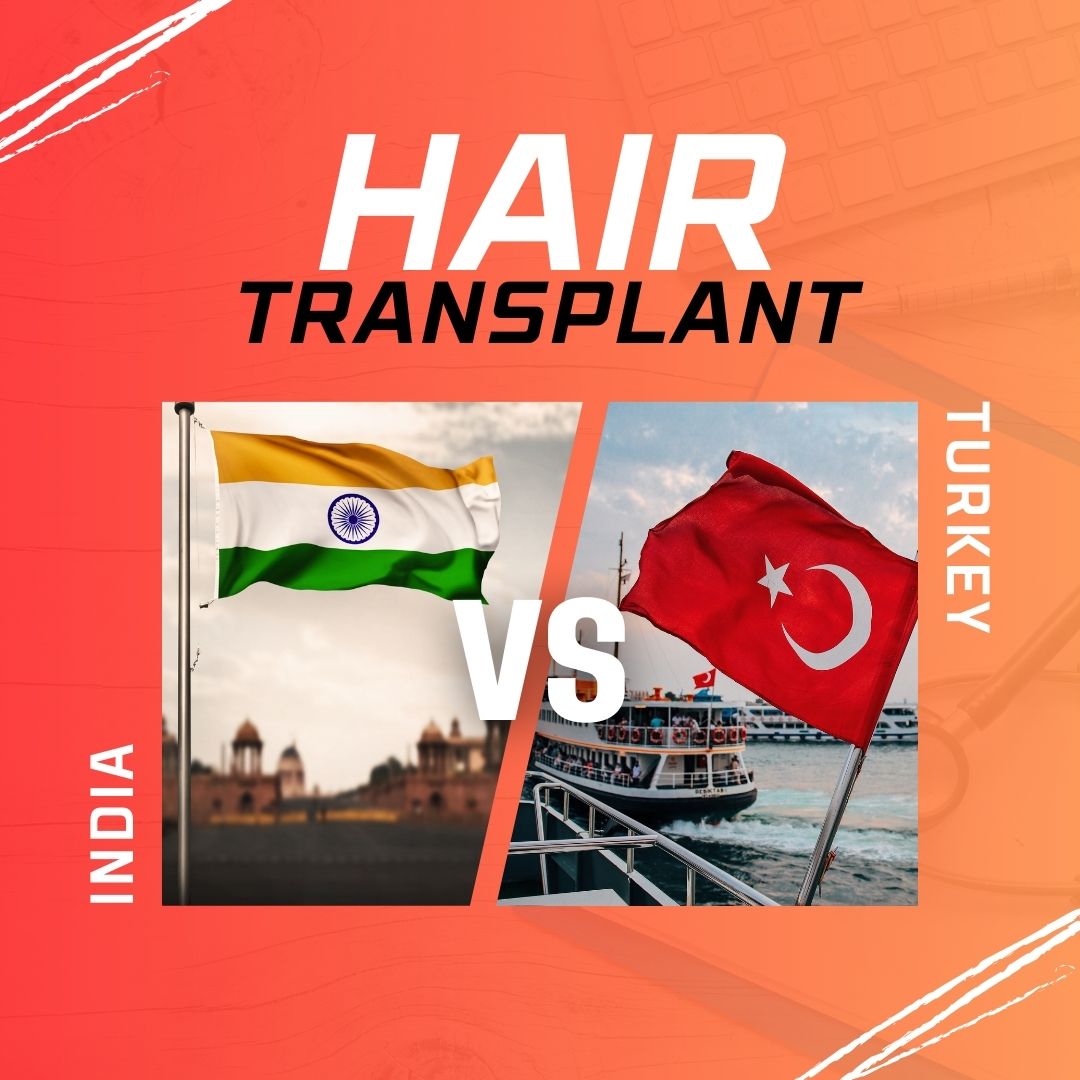 hair transplant india vs turkey