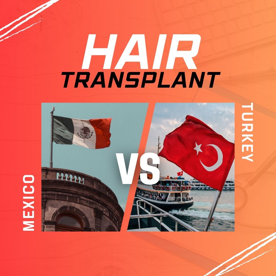 hair transplant mexico vs turkey