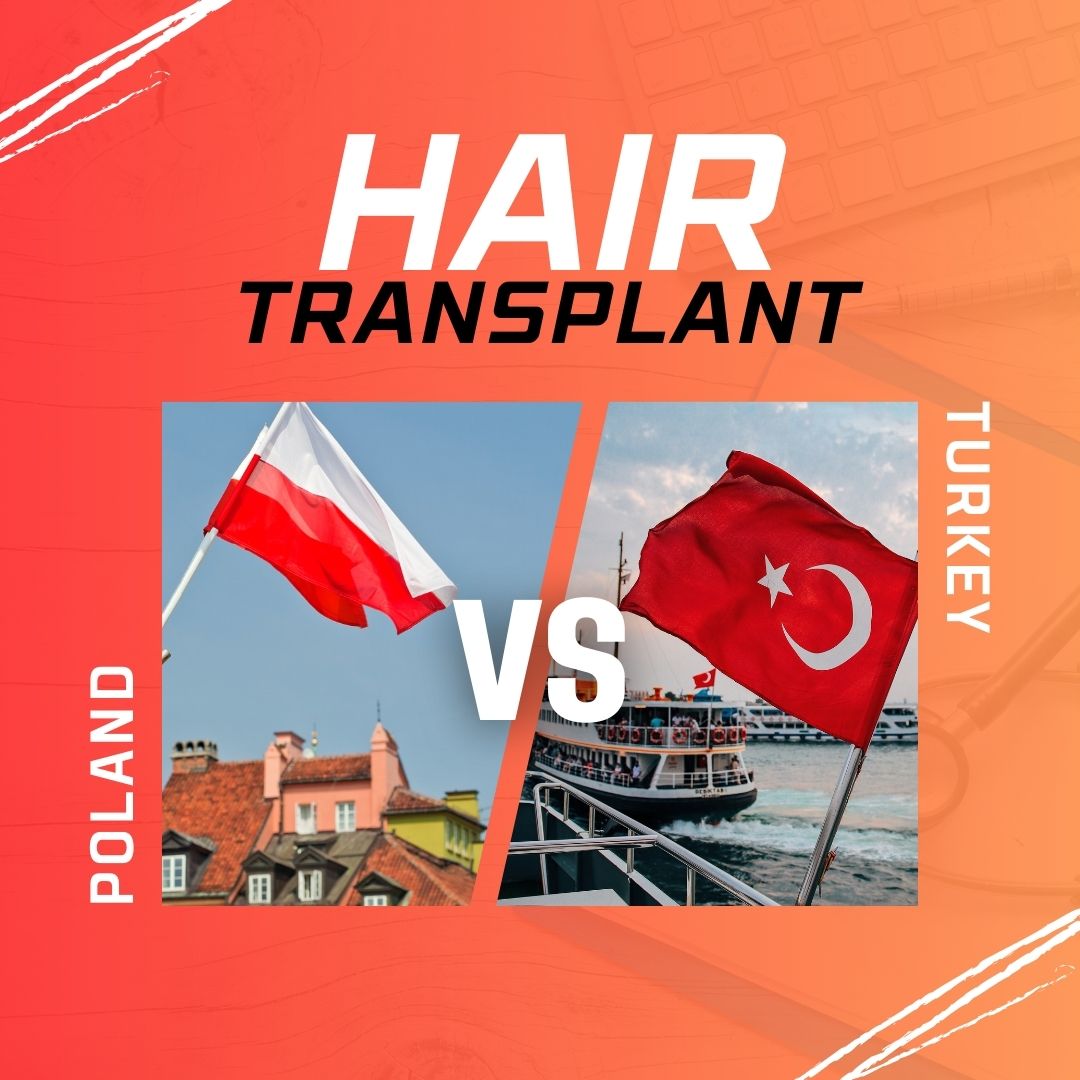 hair transplant poland vs turkey