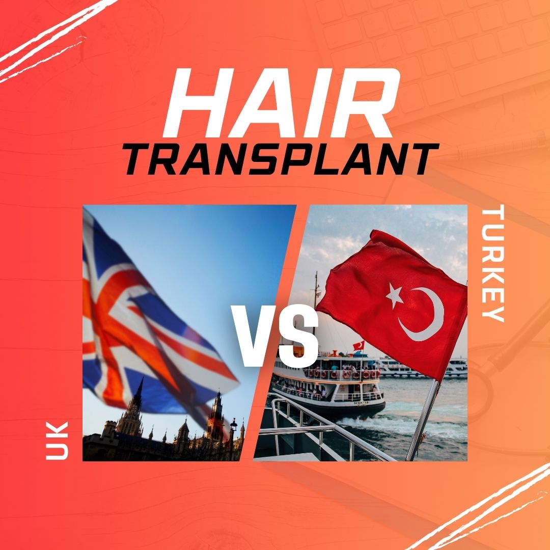 hair transplant uk vs turkey