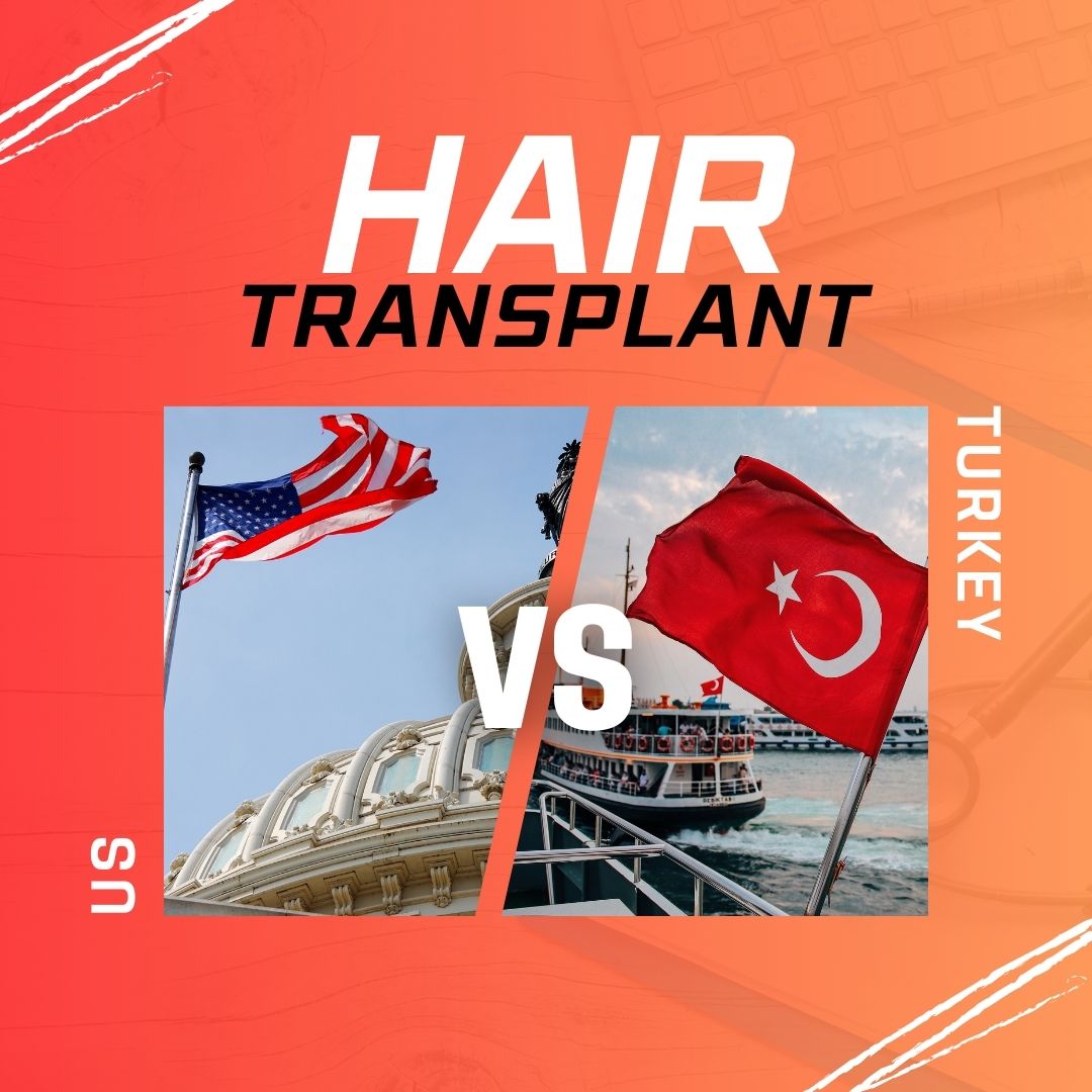 hair transplant us vs turkey