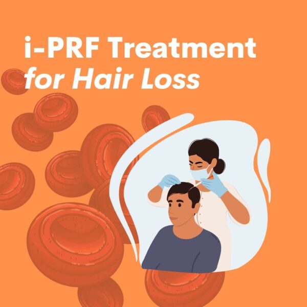 i-PRF Treatment for Hair Loss