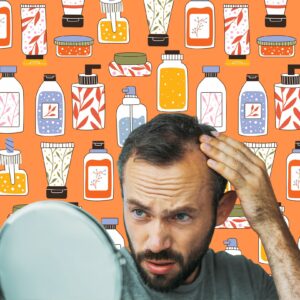 Minoxidil (Rogaine) and Hair Transplant 