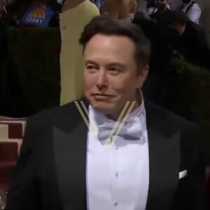 elon musk after hair transplant result