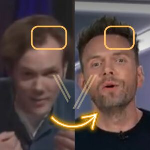 joel mchale before and after hair transplant 
