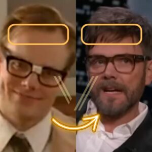 joel mchale hair transplant before after