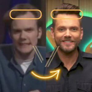 Joel McHale s Hair Transplant Before and After Transformation