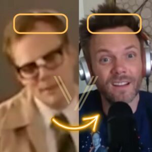 joel mchale hair transplant before and after result