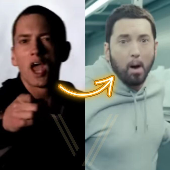 Eminem Beard Transplant Before And After Transformation