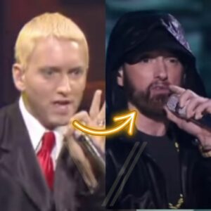 eminem bears transplant before and after