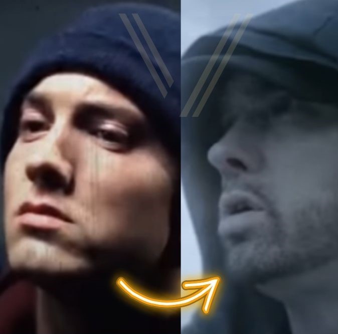 Eminem Beard Transplant Before and After Transformation