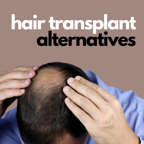hair transplant alternatives