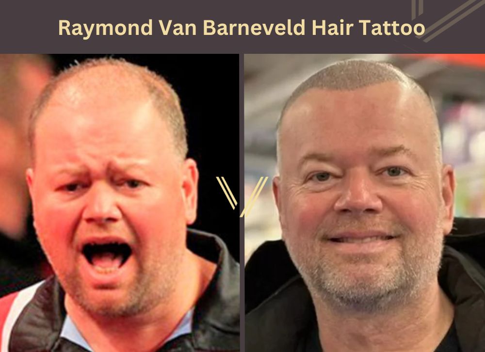 raymond van barneveld hair tattoo before after