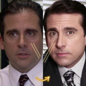 steve carell hair transplant before and after result