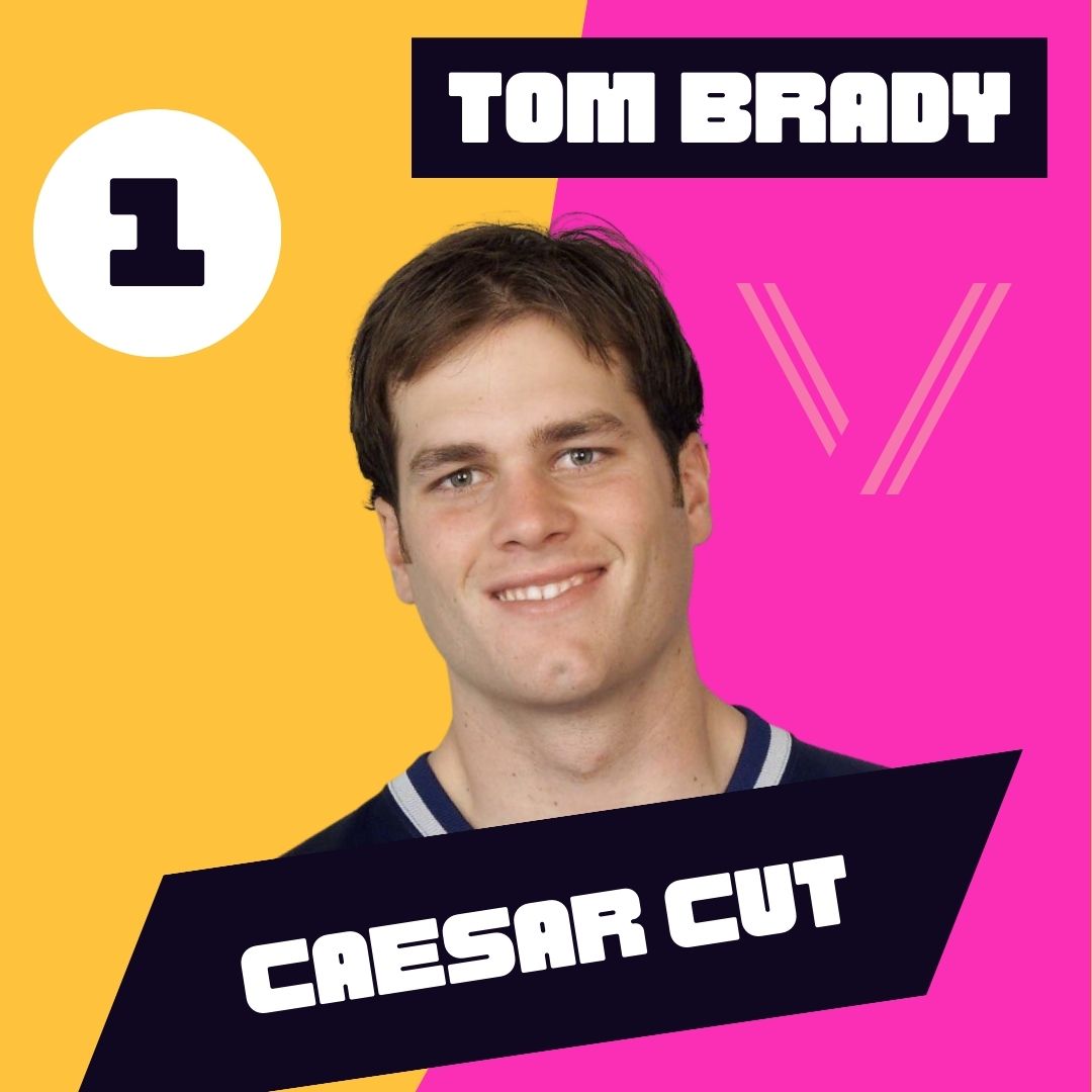 Tom Brady Hair Transplant: Before and After Transformation