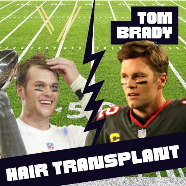 tom brady hair transplant