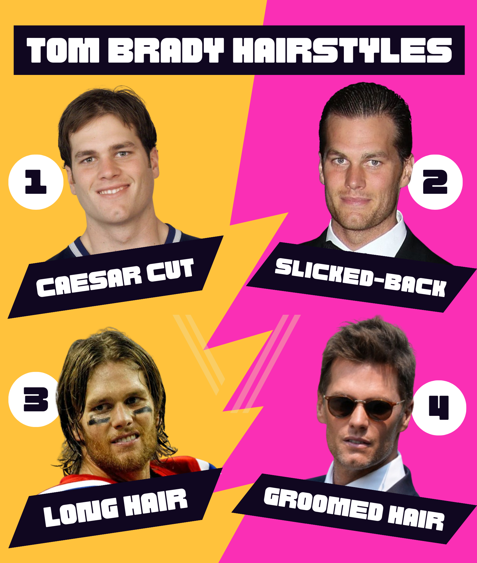 Tom Brady Hair Transplant: Before and After Transformation