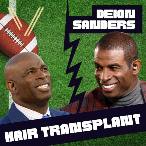 deion sanders hair transplant