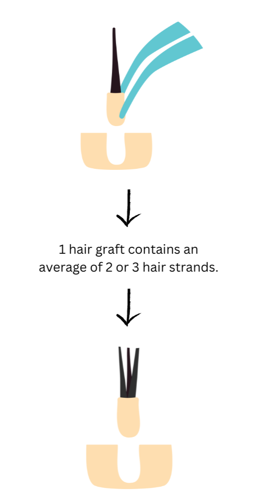 hair graft and hair strands
