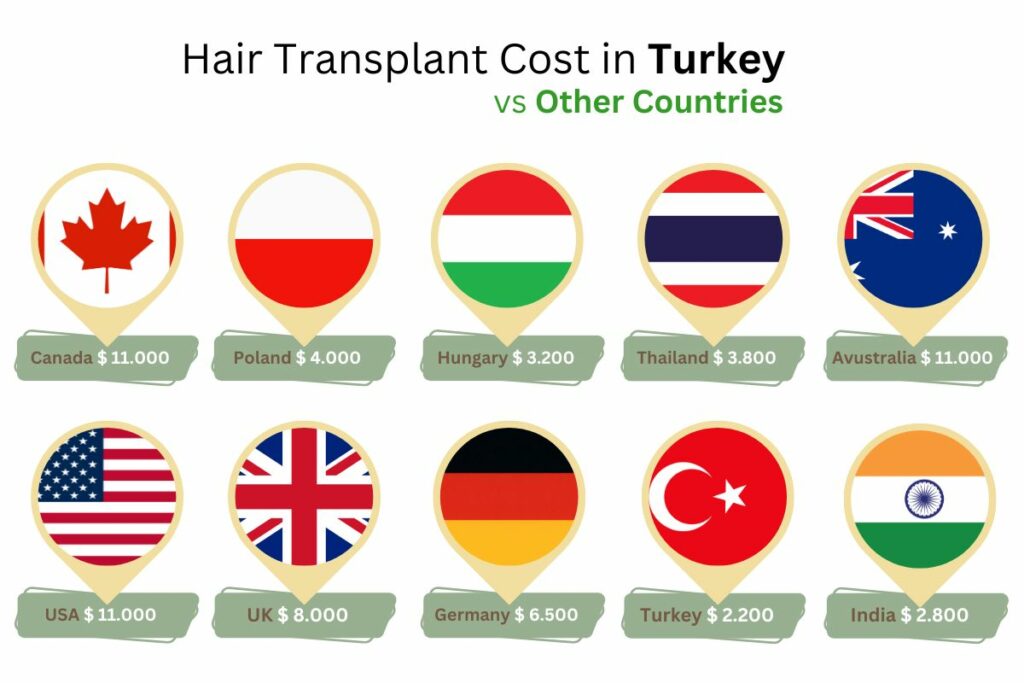 Hair Transplant Cost in Turkey vs Other Countries