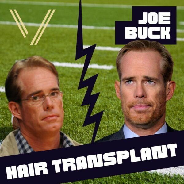 joe buck hair transplant