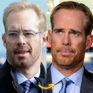 joe buck hair transplant before and after result