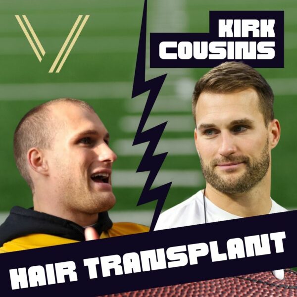 Kirk Cousins' Hair Transplant