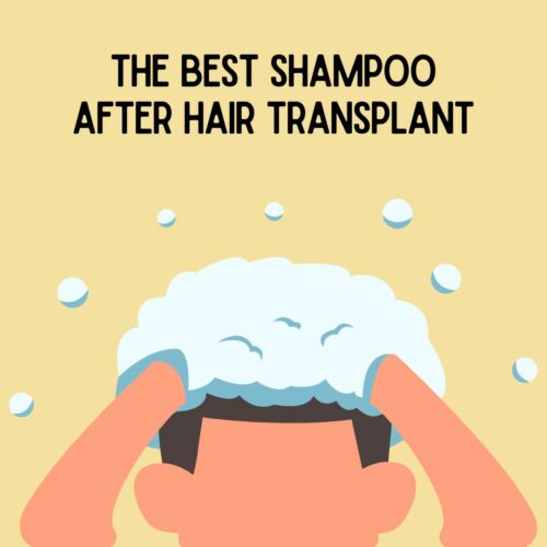 the best shampoo after hair transplant