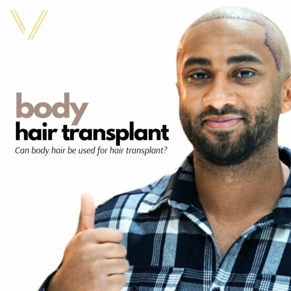 body hair transplant