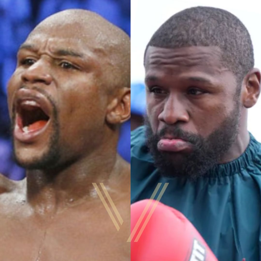 Floyd Mayweather Hair Transplant: Before and After Result