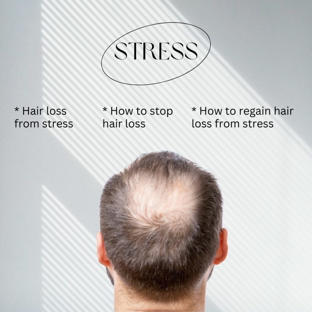 hair loss from stress