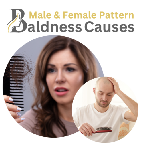 Male and Female Pattern Baldness Causes