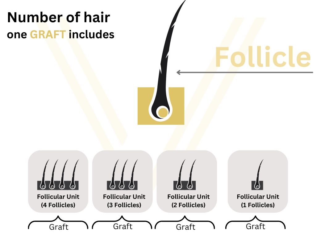 Number of hair one GRAFT includes