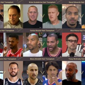 basketball players with hair transplants