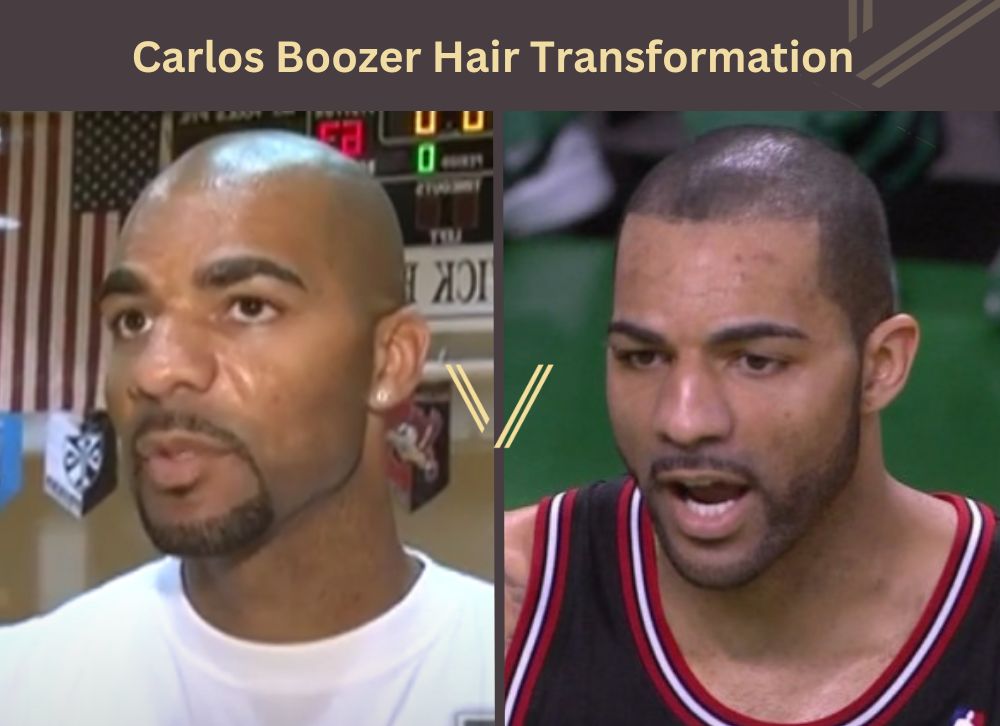 carlos boozer hair transformation