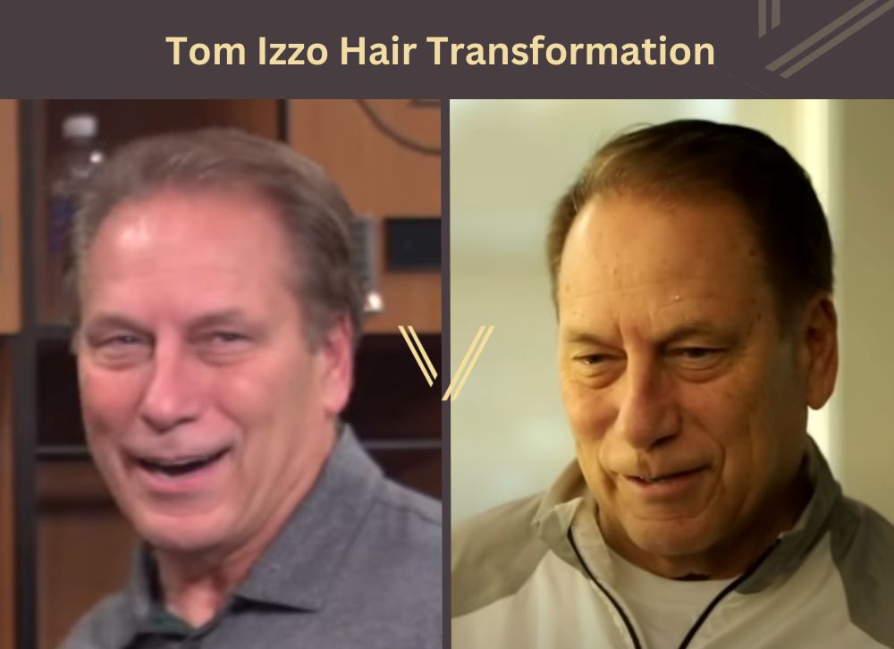 tom izzo hair transformation