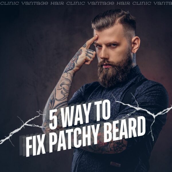5 Way to Fix Patchy Beard
